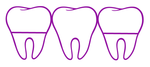 Зубной мостовидный протез