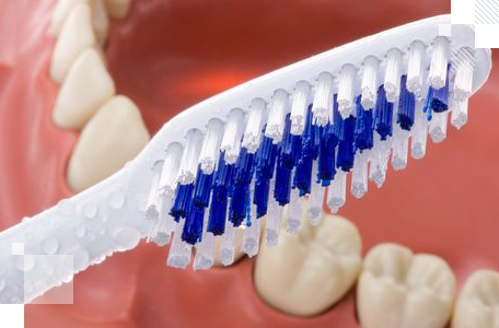 Як доглядати зубний протез з нейлону