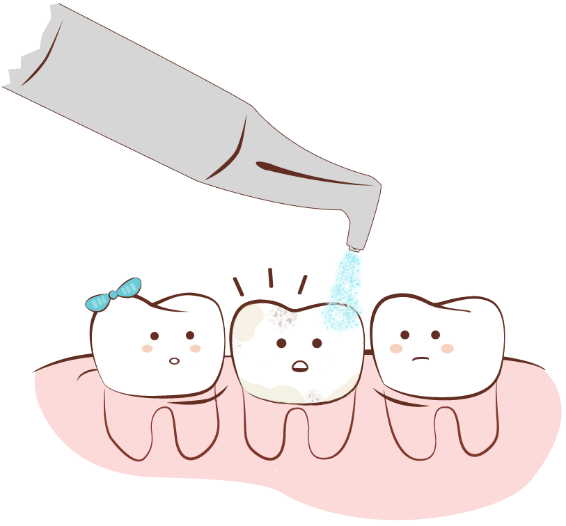 Чистка зубов Киев: частный стоматолог