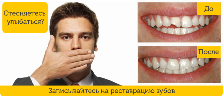 Реставрация зубов в Киеве - частный стоматолог