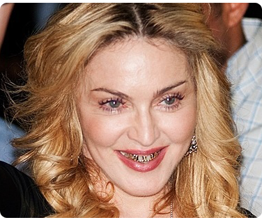 Украшения для зубов у Мадонны